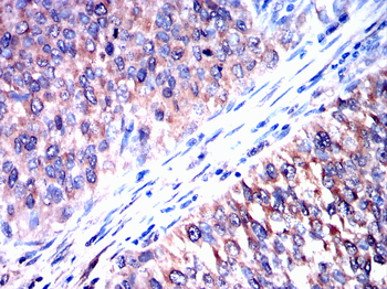 ATF5 Antibody
