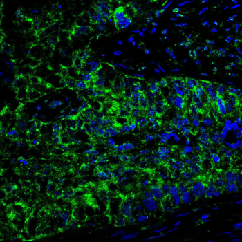 ATF5 Antibody
