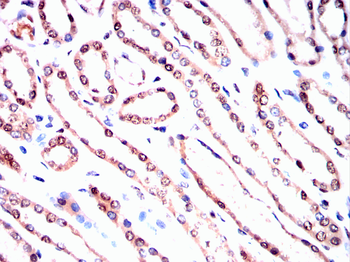 ATF5 Antibody