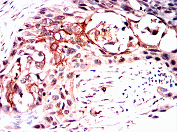 ATF5 Antibody