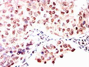 ATF5 Antibody
