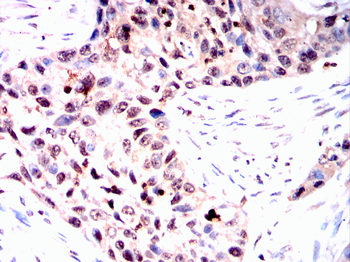 STAT5A Antibody