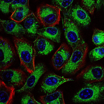 TOP2A Antibody