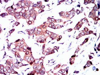 TOP2A Antibody