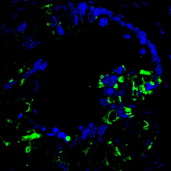 TOP2A Antibody