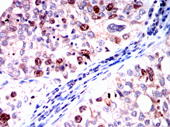 TOP2A Antibody