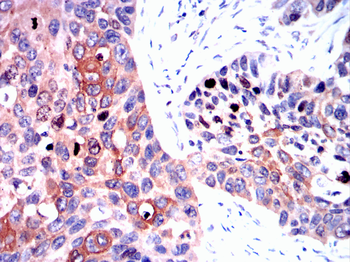 TOP2A Antibody