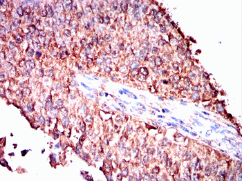 PGK1 Antibody