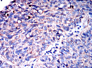 PGK1 Antibody