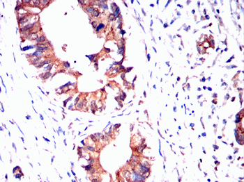 PGK1 Antibody