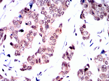 MAPK9 Antibody