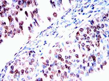 MAPK9 Antibody