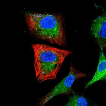 CD1A Antibody