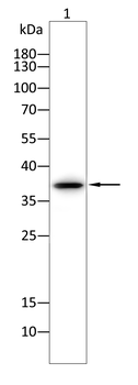 CD1A Antibody