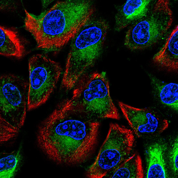 CHRNB1 Antibody