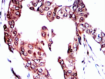 BRAF Antibody
