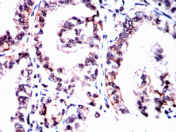 BRAF Antibody