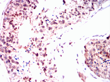 BRAF Antibody