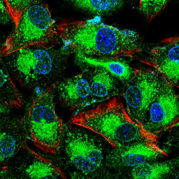 PKHD1 Antibody