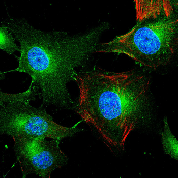 MMP11 Antibody