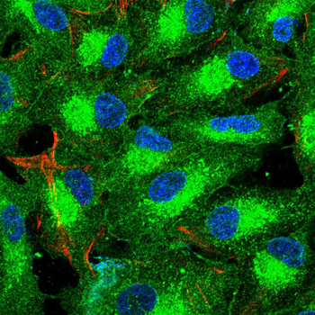 HSPB8 Antibody