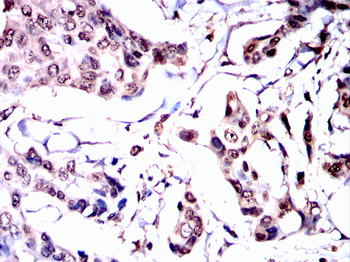 HSPB8 Antibody