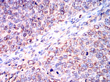 HSPB8 Antibody