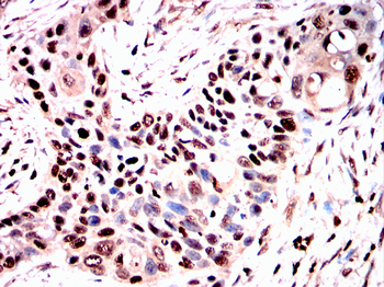 HSPB8 Antibody