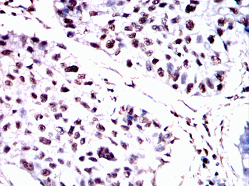 HSPB8 Antibody
