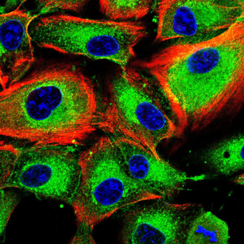 EIF2AK2 Antibody