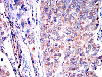 EIF2AK2 Antibody