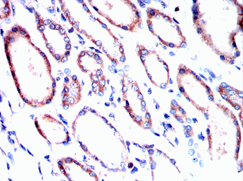 EIF2AK2 Antibody