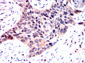 EIF2AK2 Antibody