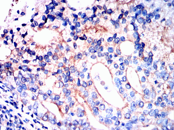 EIF2AK2 Antibody