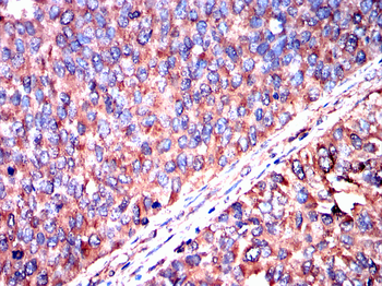 HPRT1 Antibody