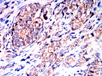 HPRT1 Antibody