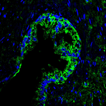 HPRT1 Antibody