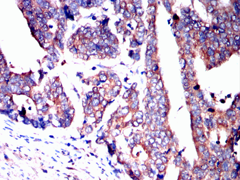 DLG2 Antibody