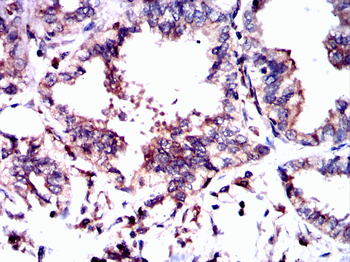 DLG2 Antibody