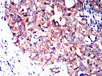 DLG2 Antibody