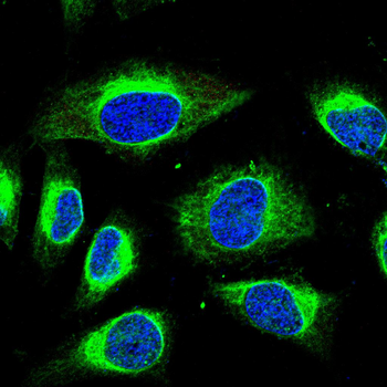 PFKM Antibody