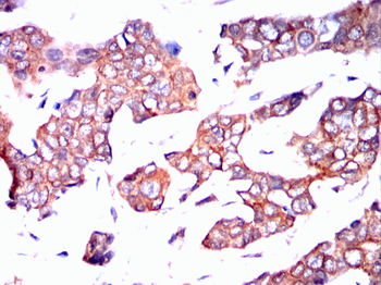 PFKM Antibody