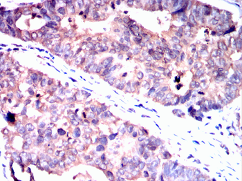 PFKM Antibody