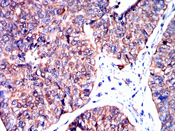 PFKM Antibody
