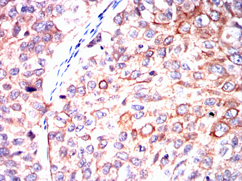 PFKM Antibody