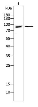 PFKM Antibody
