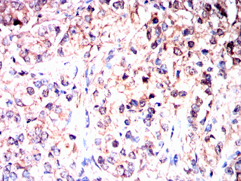 HTT Antibody