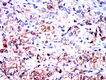 DSG2 Antibody