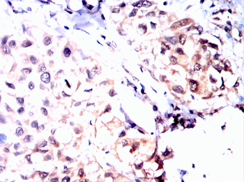 TOP1 Antibody