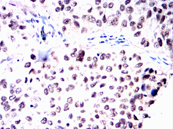 TOP1 Antibody